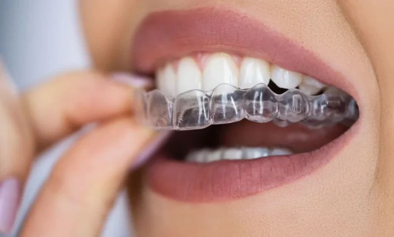 Invisalign in Bullhead City