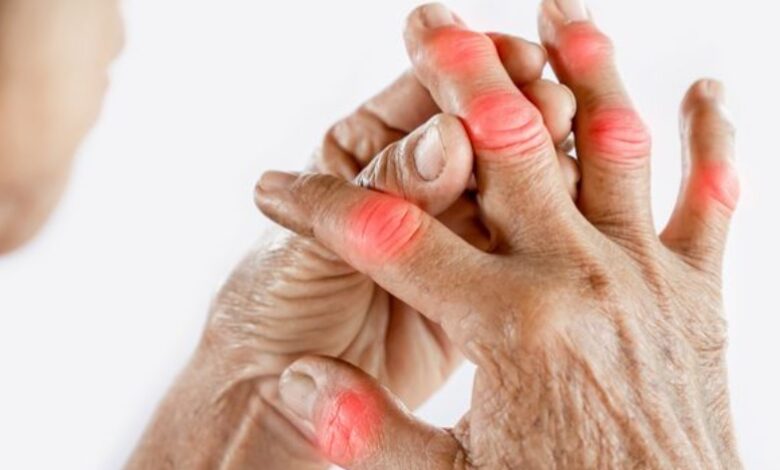 Rheumatoid Arthritis