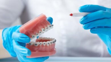 What Gingival Barrier Is And Why It Matters For Your Dental Care