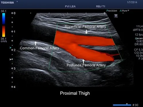 Doppler ultrasound scan services