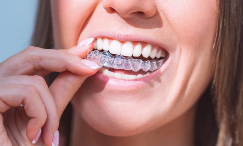 Invisalign Treatment