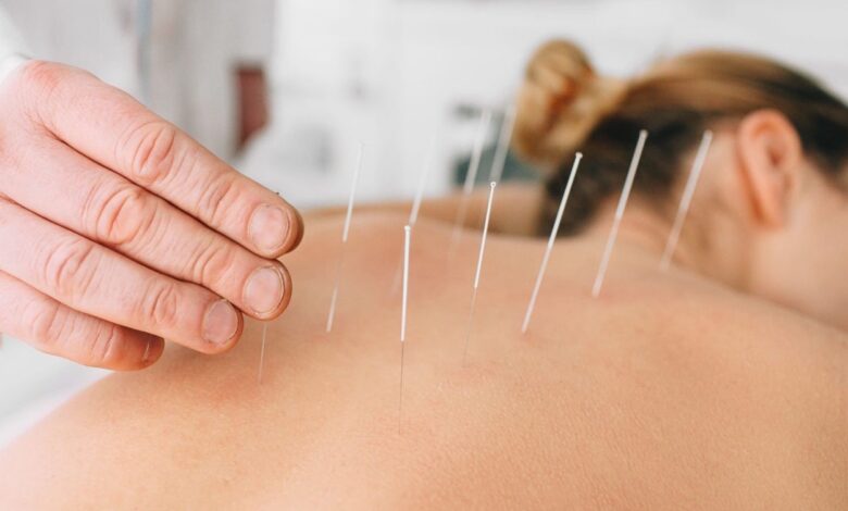 acupuncture in orange county