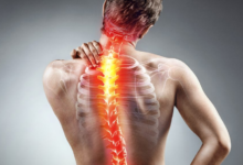 Muscle Pain Treatment Effective Strategies for Relief