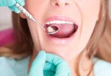 How to Protect Your Teeth from Decay and Erosion with Dentist Penrith