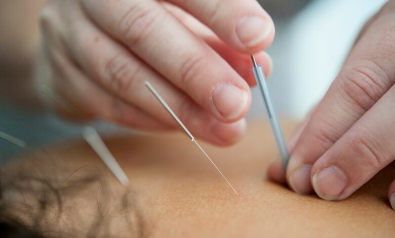acupuncture treatment winnipeg