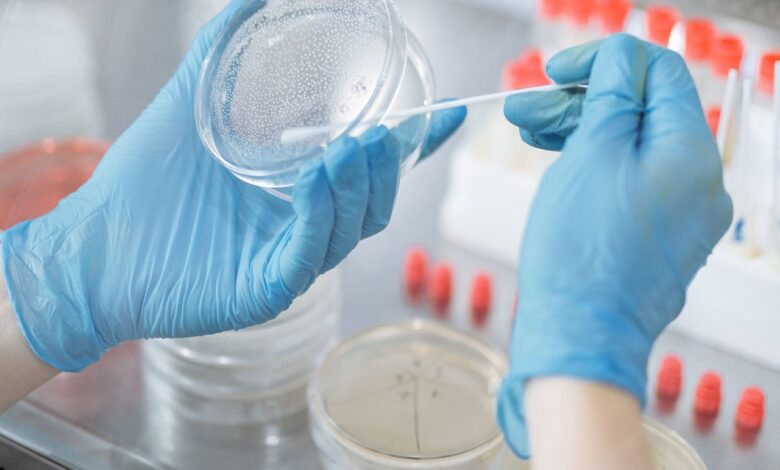 Legionella Testing Market